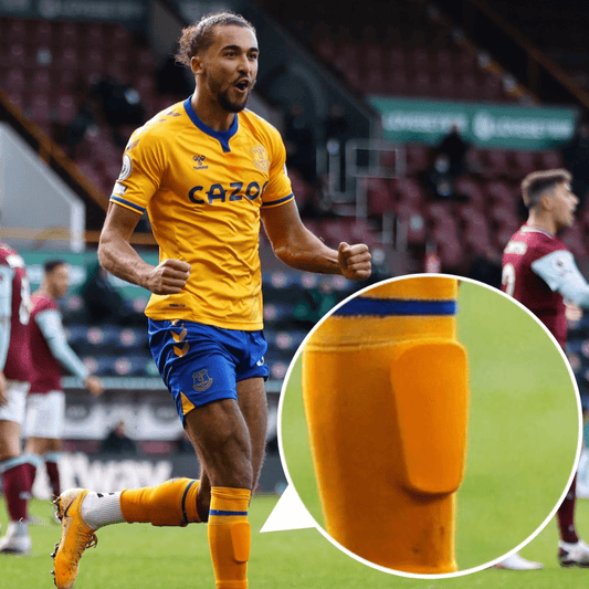 Zijn Mini Scheenbeschermers Legaal? De Officiële Regels